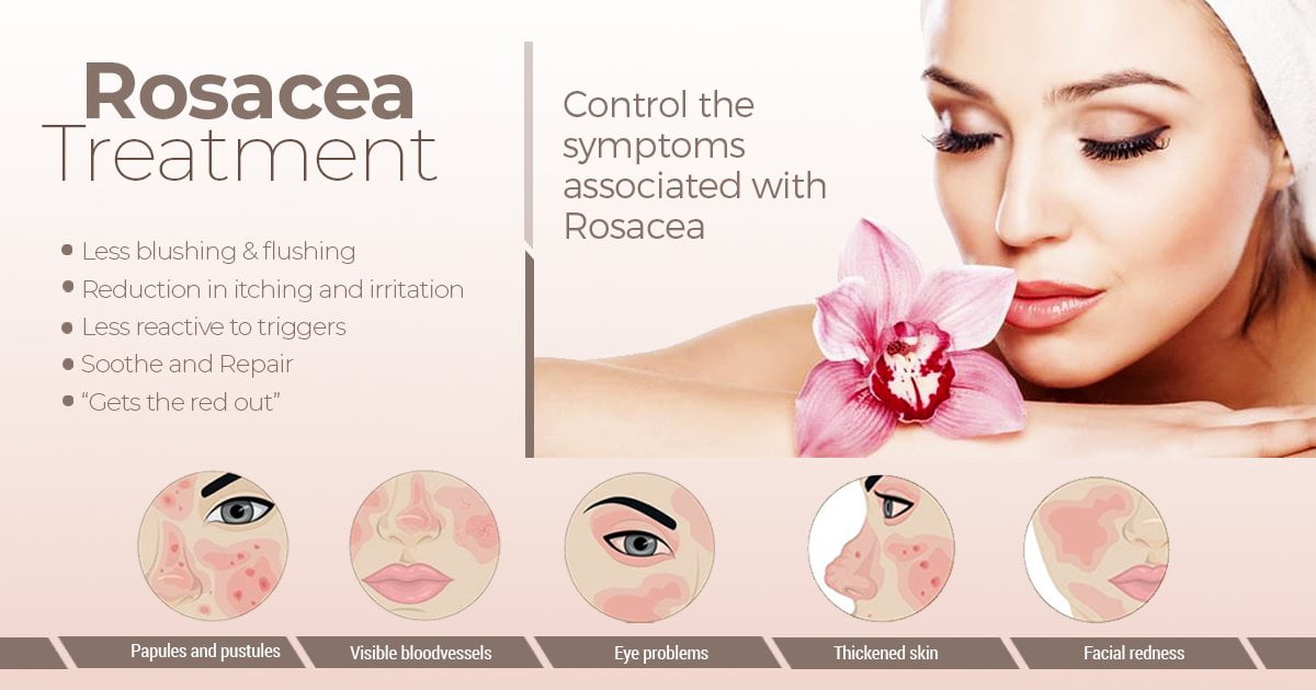 Rosacea Treatment Banner in Windsor & Hartford, CT | CMA PrimaryCare & MedSpa